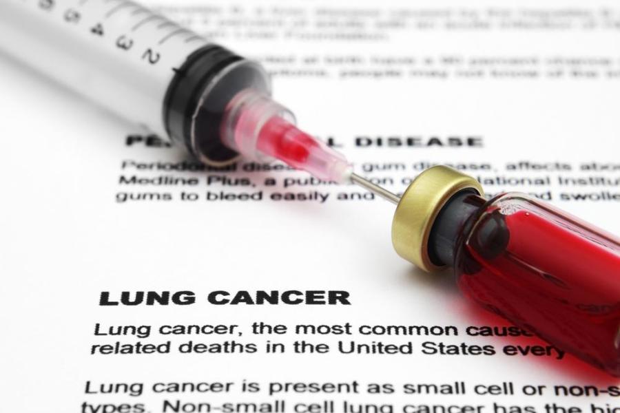 Treatment of Lung Cancer