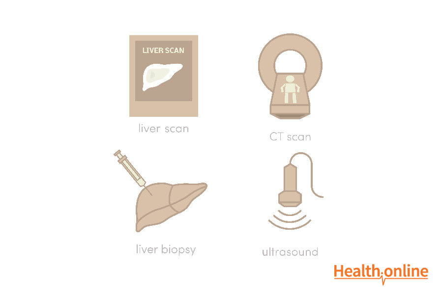 Tests and Diagnosis of Liver Cancer