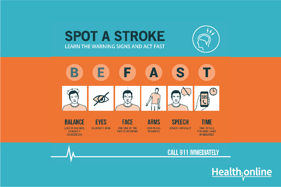 Symptoms of Stroke