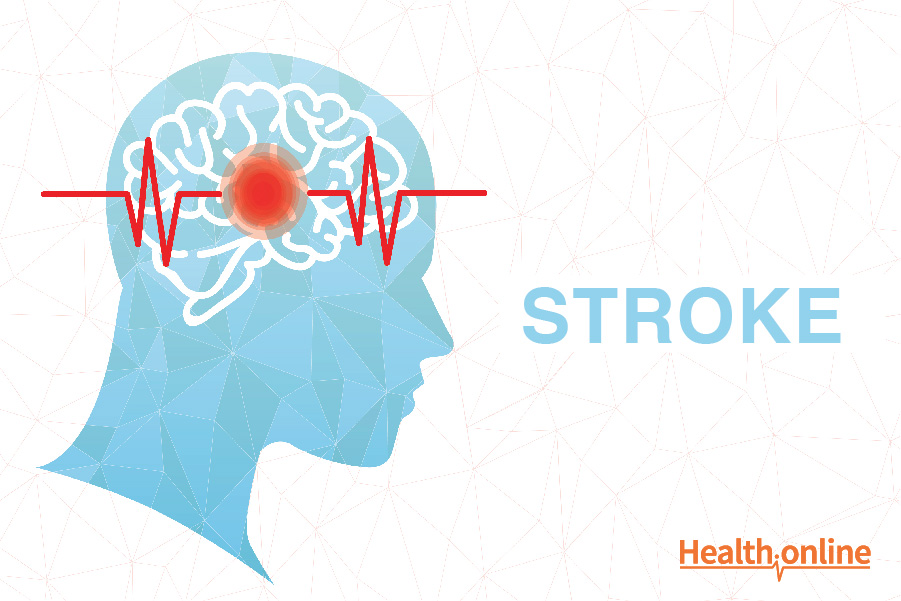 Introduction and Types of Stroke