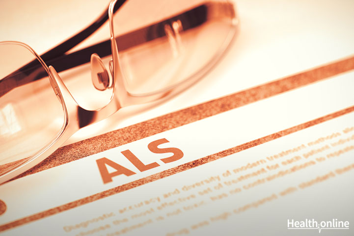 Amyotrophic Lateral Sclerosis (ALS): Introduction &#038; Causes