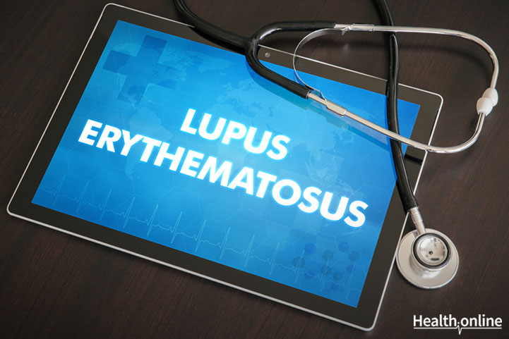 Associated Symptoms of Systemic Lupus Erythematosus