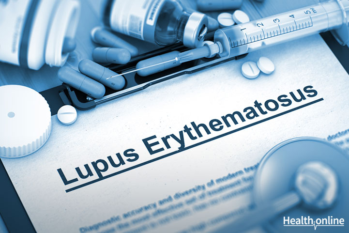 Complications of Systemic Lupus Erythematosus