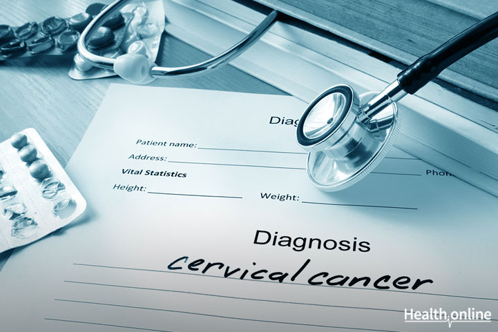 Diagnosis and Stages of Cervical Cancer