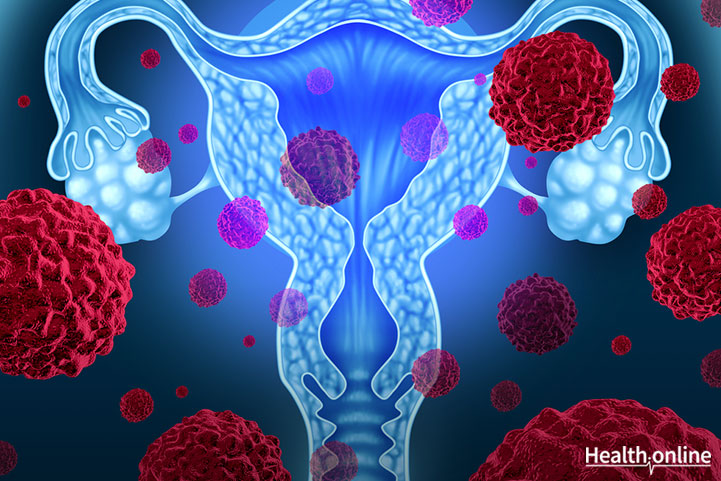 Symptoms and Risk Factors for Cervical Cancer