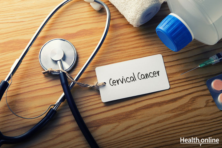 Treatment and Prognosis of Cervical Cancer