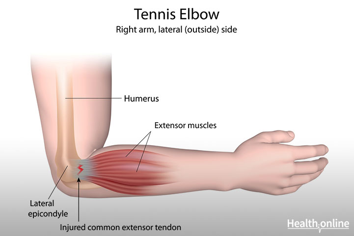 Anatomy of an Elbow Joint