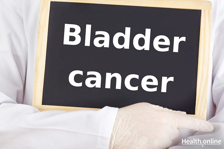 Bladder Cancer Treatment and Survival Rates