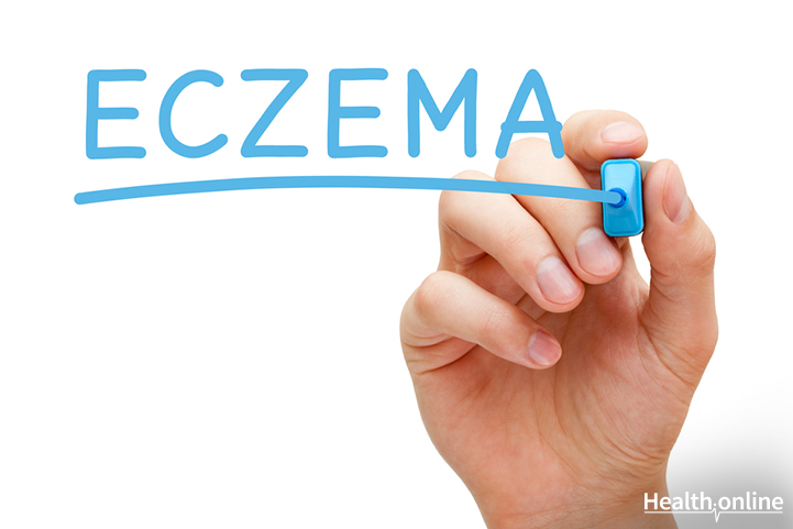 Causes of Eczema