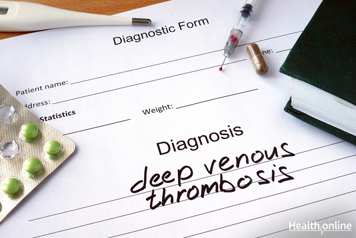 Complications &#038; Diagnosis of DVT