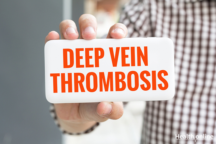 Introduction &#038; Symptoms of Deep Venous Thrombosis (DVT)