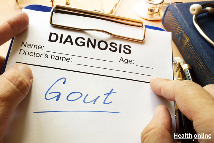 Gout Exams, Tests, and Diagnosis