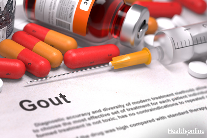 Gout Treatment and Prevention