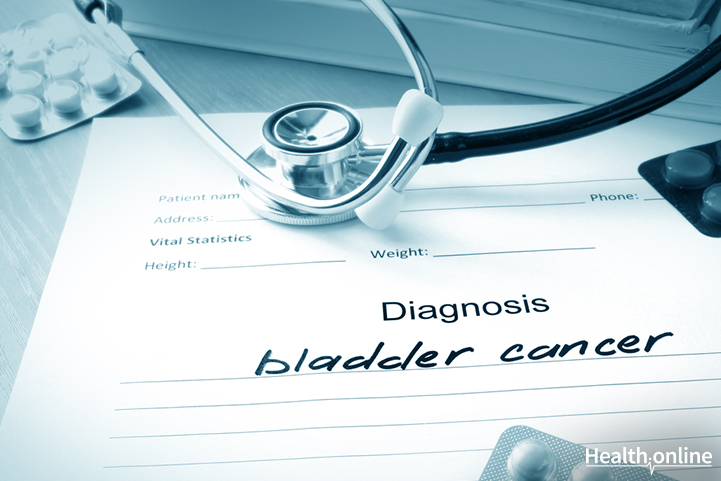 8 Tests that Help Diagnose Bladder Cancer