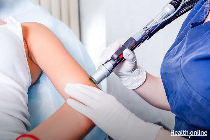 Laser Hair Removal: What to Expect During a Treatment