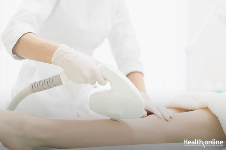 Your Guide to Laser Hair Removal