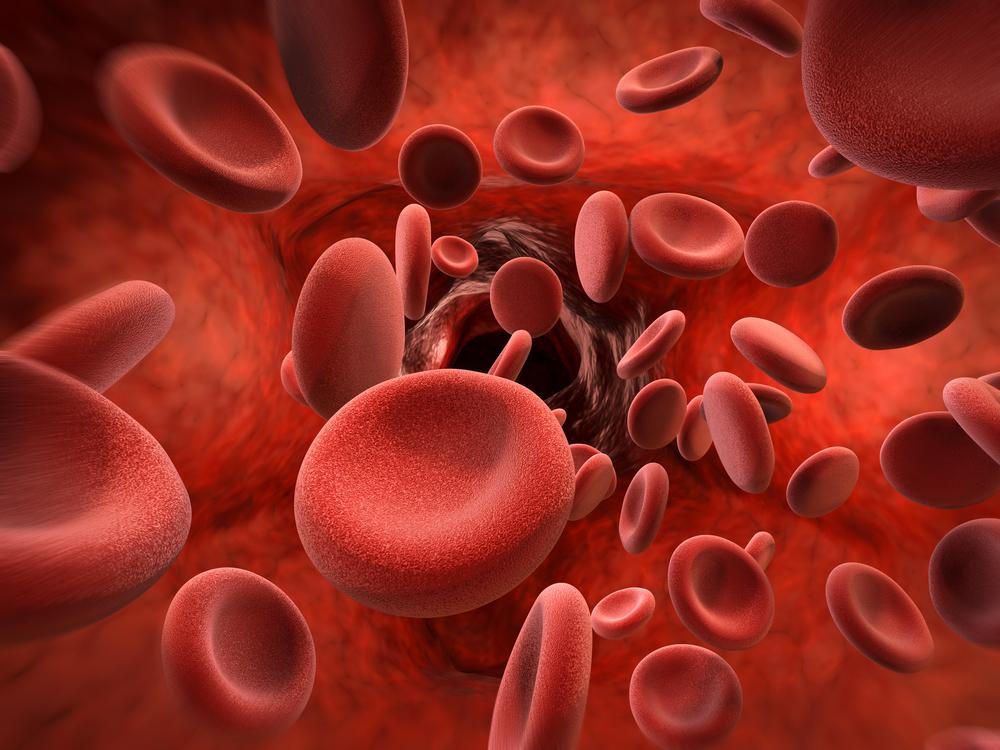 Common Causes and Symptoms of Blood Clots