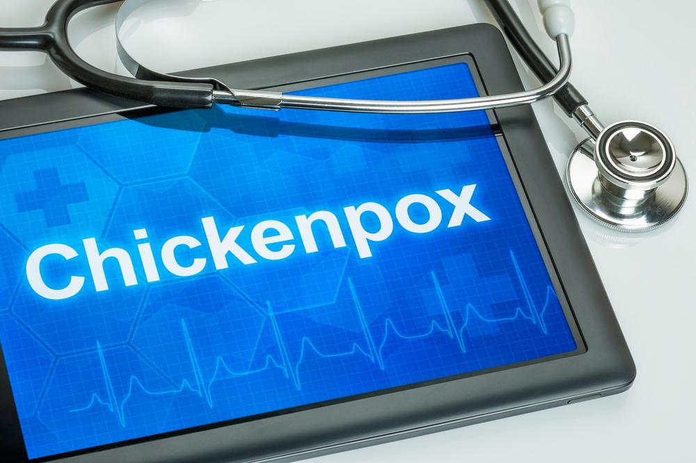 Interesting facts about the chickenpox vaccine