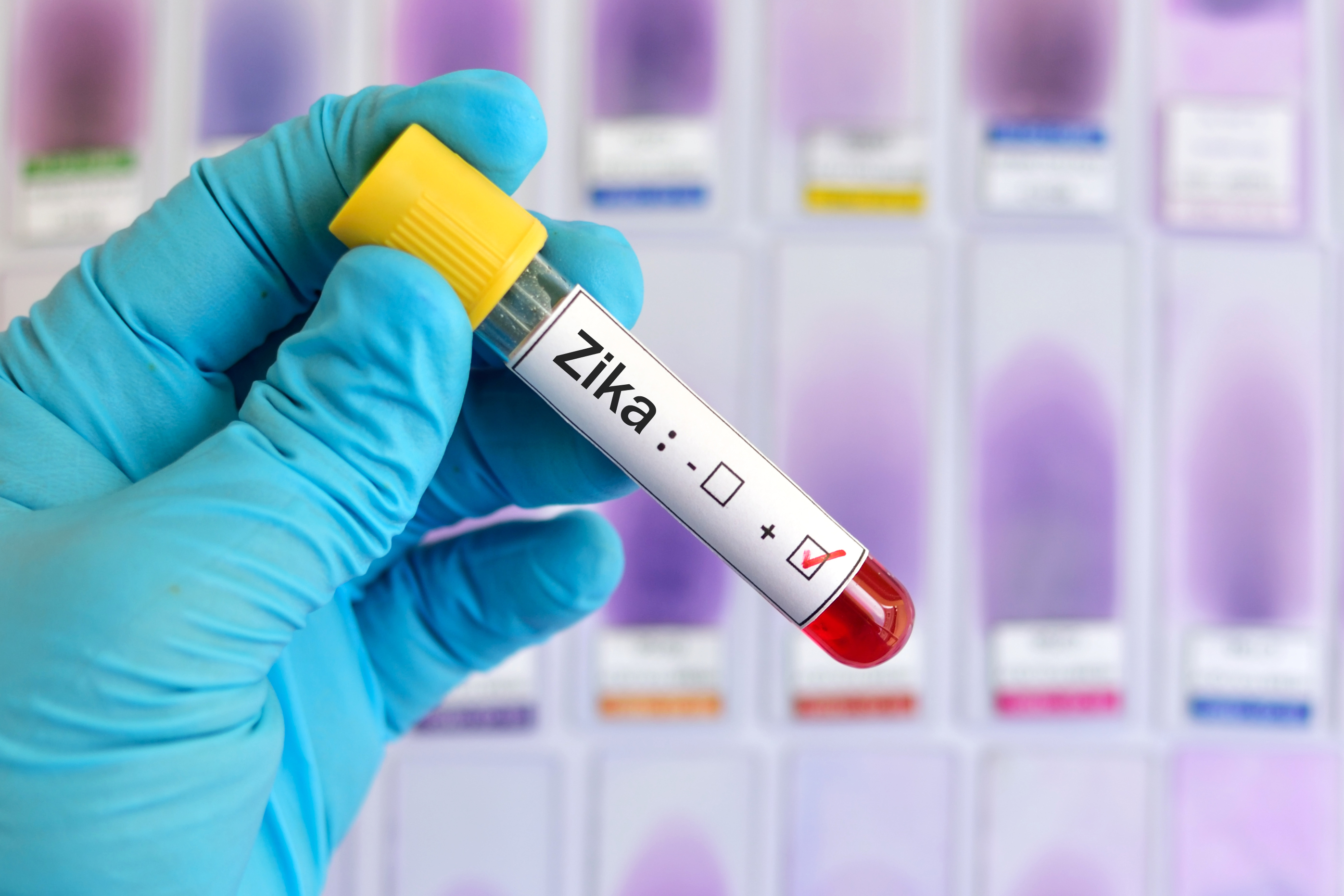 Symptoms and diagnosis of the zika virus