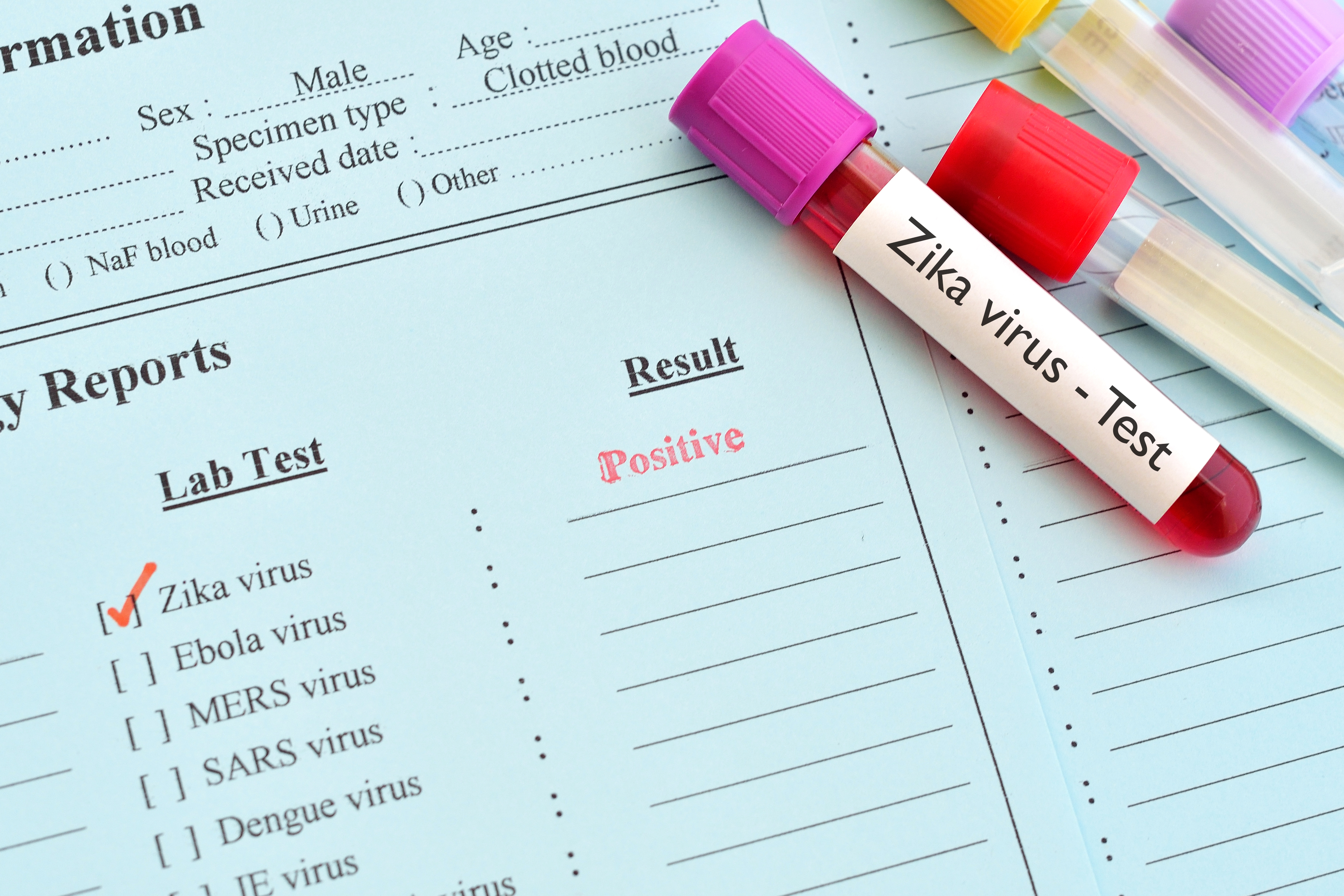 Zika Virus – An Introduction