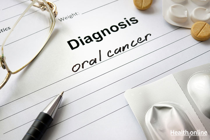 Diagnosis of Oral Cancer