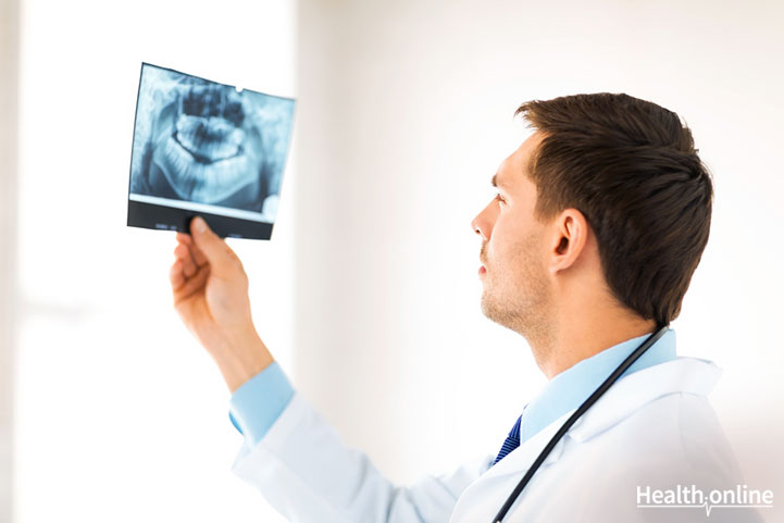 Treatment and Prognosis of Oral Cancer