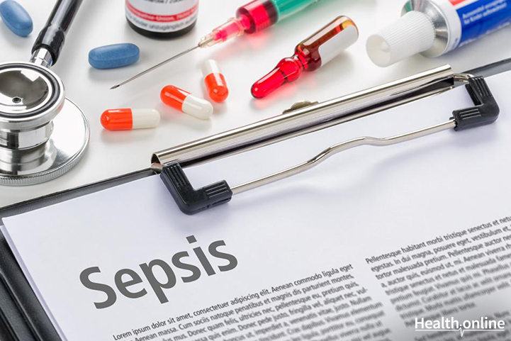 Adjunctive Treatment Measures for Sepsis