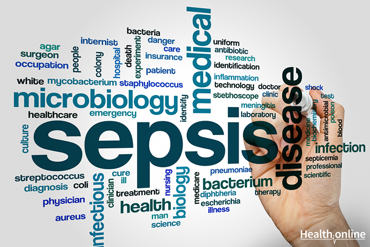 The Mechanisms that Underlie Sepsis