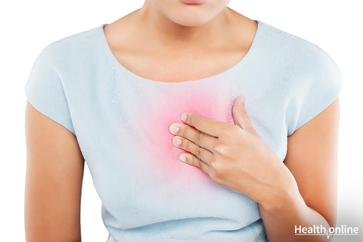 Myths and Facts about Heartburn