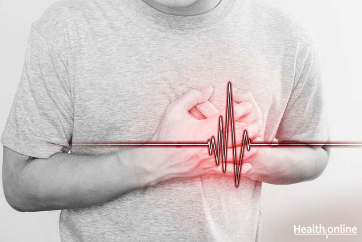 Angina Pectoris: An Overview