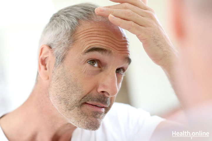 Greying Hair: The Causes and The Cure