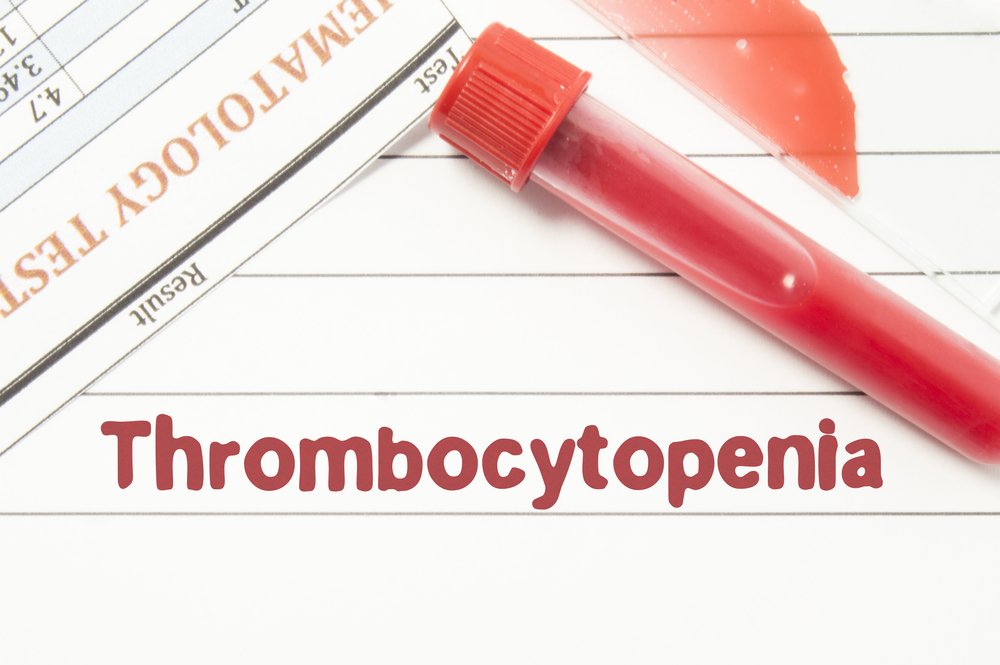 Treatments for Immune Thrombocytopenia (ITP)