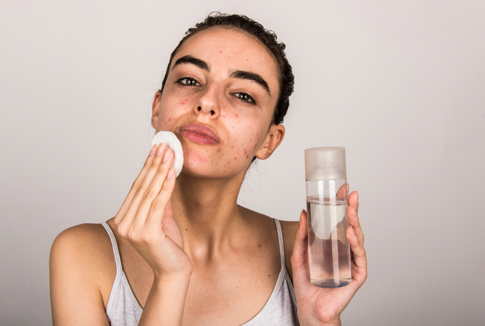 Transform Your Skin: The Best Teen Acne Solutions Uncovered